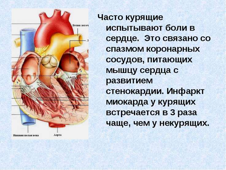 Боли связан с болезнью сердца Боли связан с болезнью сердца
