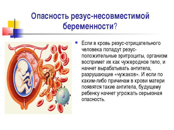 Резус иммунизация беременных протокол 14
