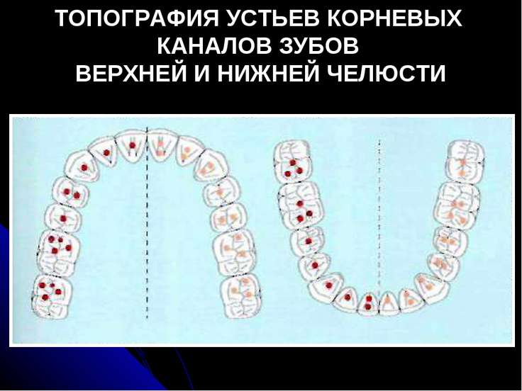Фото расположения каналов зубов Фото расположения каналов зубов