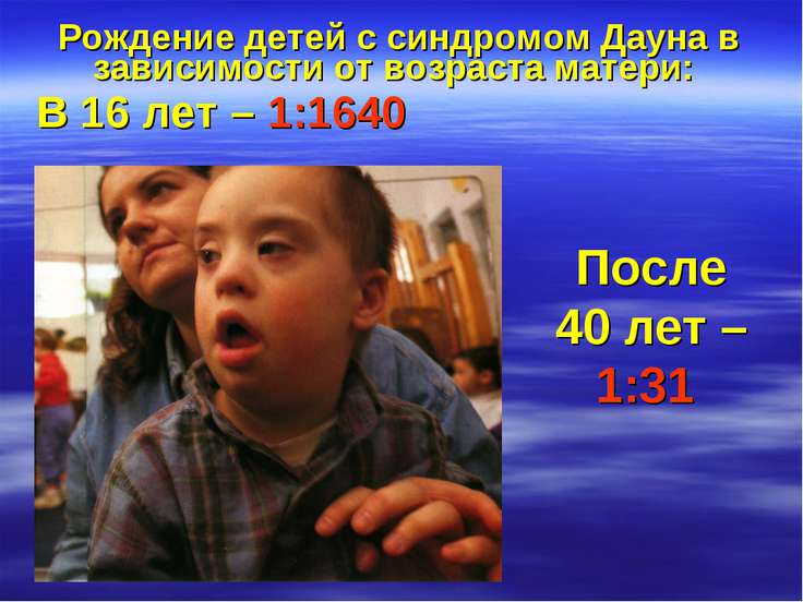 Прцедура отказа от ребенка с синдромом дауна Нет, ответил