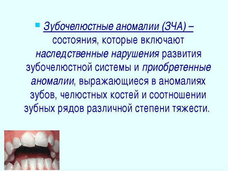 Наследственные пороки развития зубов это Наследственные пороки развития зубов это