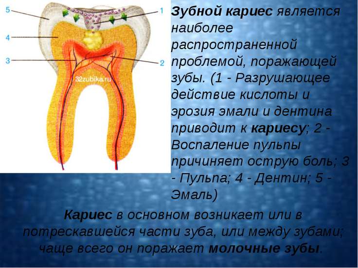 К чему приводит инфекция в зубе К чему приводит инфекция в зубе