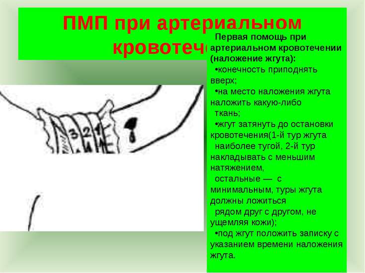 По отношению к ране артериальный жгут накладывают По отношению к ране артериальный жгут накладывают