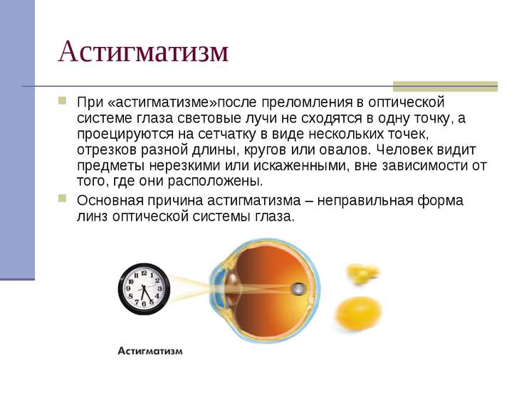 Очки для зрения цены женские фото