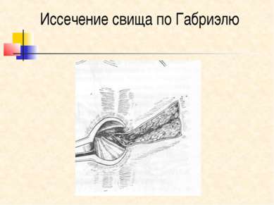 Новые средства для похудения эффективные 2016 год