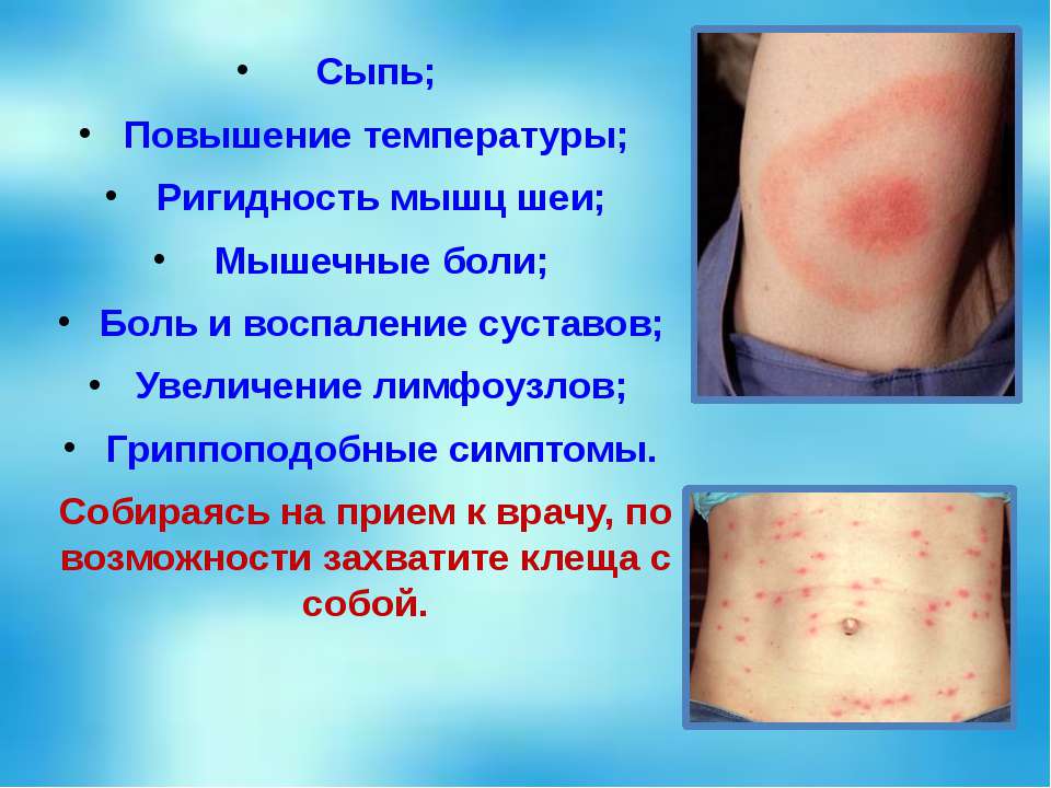Наиболее сыпь и слабость у ребенка после высокой температуры Body Belt Боди