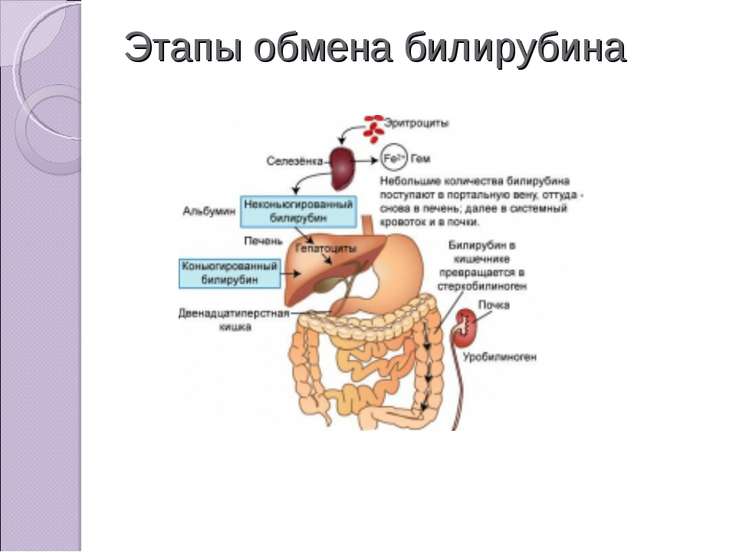 Обтурационная желтуха презентация