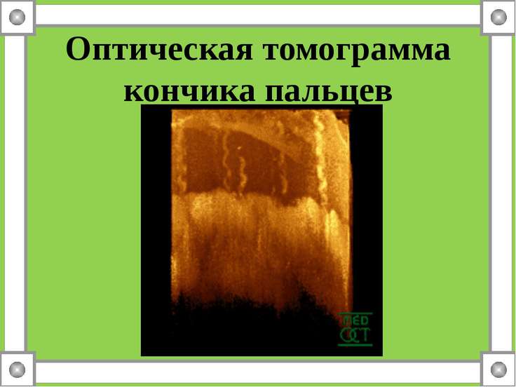 роль кожи в терморегуляции 9 класс