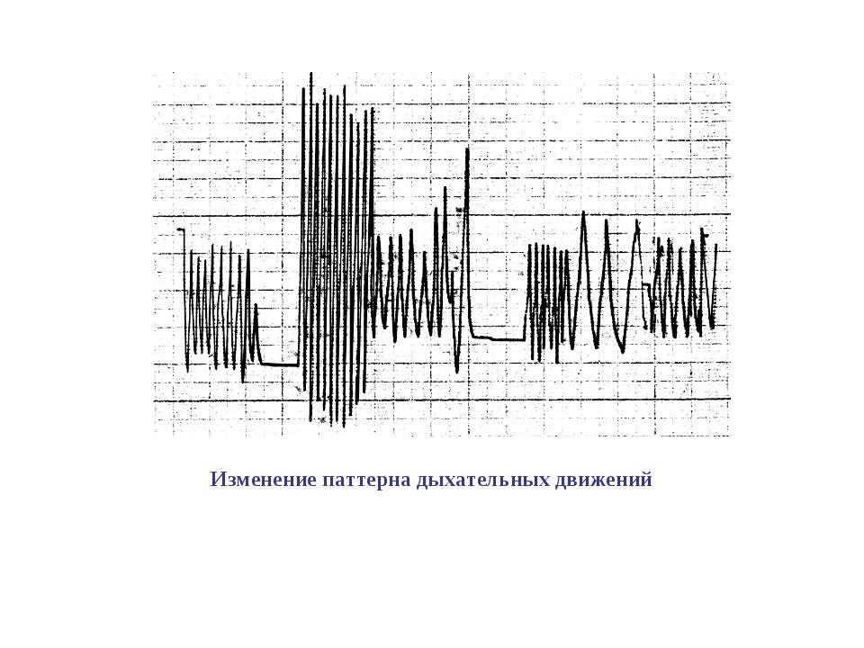 Компьютерная имитация движения с помощью изменения формы объекта или показа