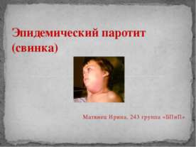 Эпидемический паротит (свинка)