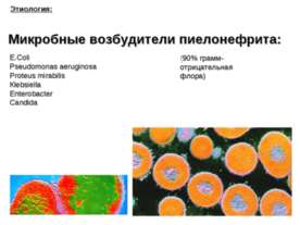 Микробные возбудители пиелонефрита