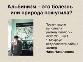 Aльбинизм – это болезнь или природа пошутила?
