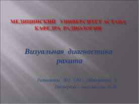 Заболевание рахит