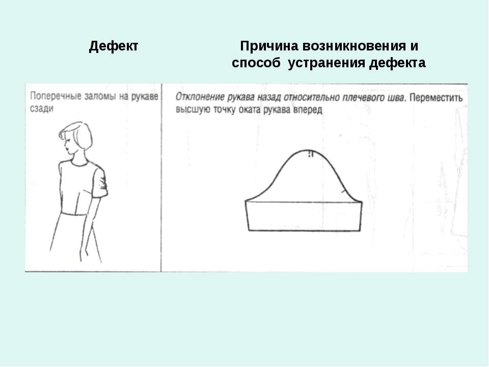 Укажите причину дефекта изображенного на рисунке юбка