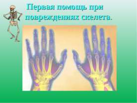 Первая помощь при повреждениях скелета