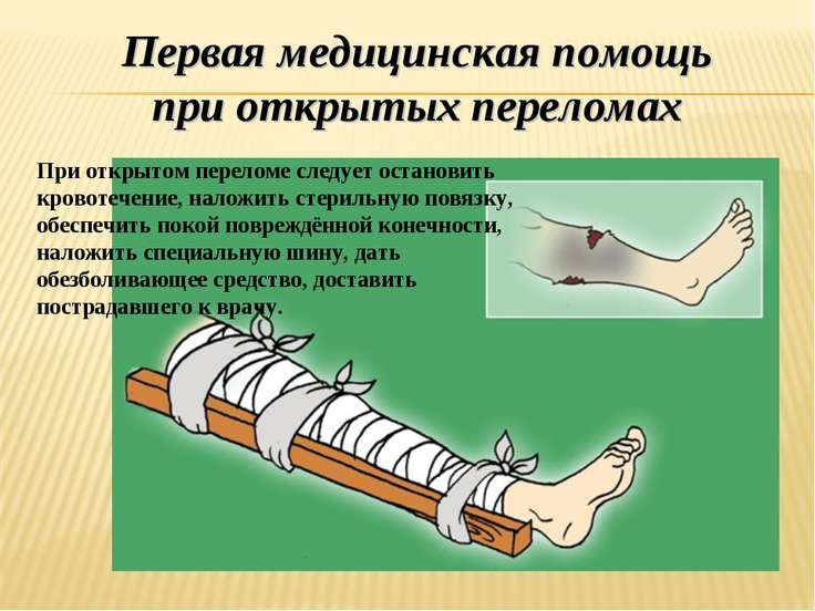 Первая медицинская помощь при остановке сердца обж 11 класс презентация