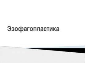 Эзофагопластика