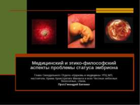 Медицинский и этико-философский аспекты проблемы статуса эмбриона