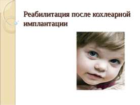 Реабилитация после кохлеарной имплантации