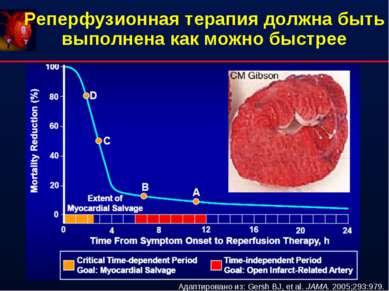 Реперфузионная терапия должна быть выполнена как можно быстрее Адаптировано и...