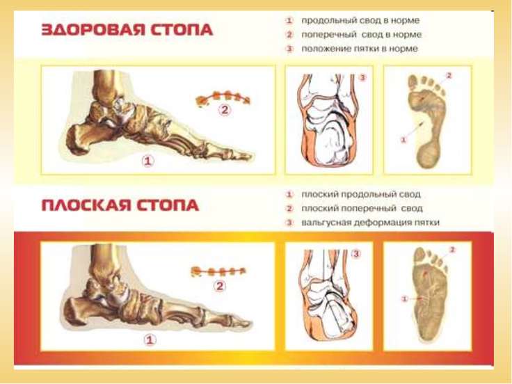 Схема постановки пиявок на ноги