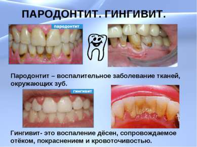 Презентация на тему чтобы зубы не болели thumbnail