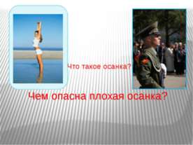 Чем опасна плохая осанка?