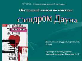 Синдром Дауна
