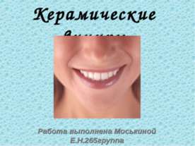 Керамические виниры