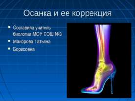 Осанка и ее коррекция