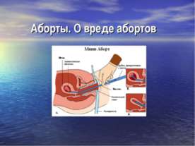 Аборты. О вреде абортов